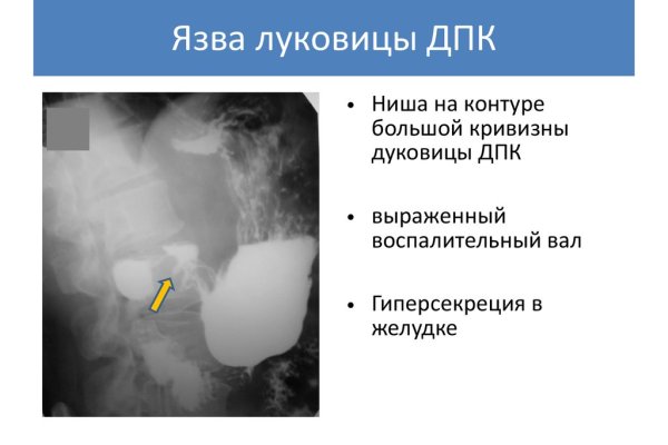 Кракен сайт krk store com